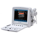 Edan U50 Ultrasound Machine for Sale